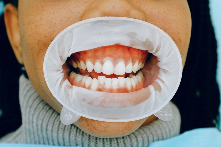 The Connection Between Sleep and Gum Health